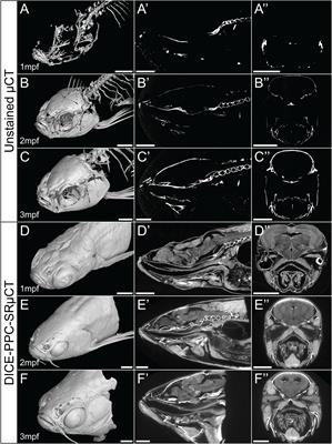 Enhanced contrast synchrotron X-ray microtomography for describing skeleton-associated soft tissue defects in zebrafish mutants